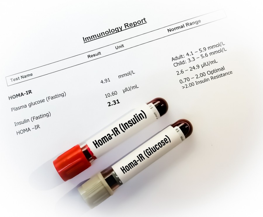 Comprendre l'indice HOMA pour une meilleure gestion de sa santé